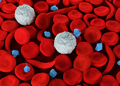 lymphoma image