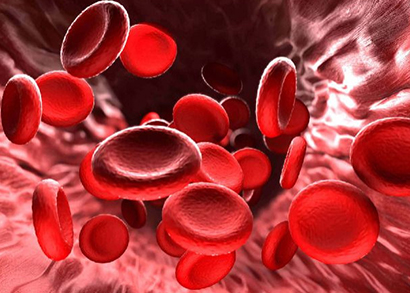 myelodysplastic syndrome image