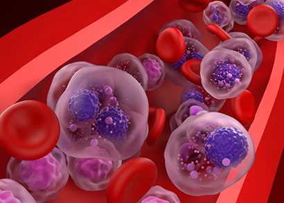 multiple myelomas image