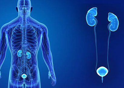 urinary bladder cancer image